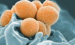 Toxic mycotoxins may be present in an increasing number of foods