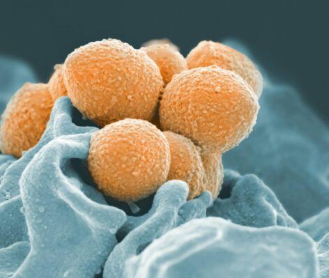 Toxic mycotoxins may be present in an increasing number of foods
