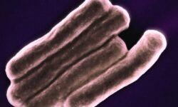 Belgiumban többen meghaltak toxint termelő E. coli baktérium okozta fertőzés következtében