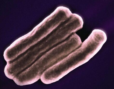 Belgiumban többen meghaltak toxint termelő E. coli baktérium okozta fertőzés következtében